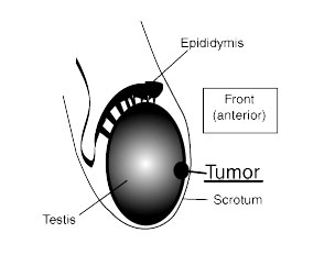 Testicular